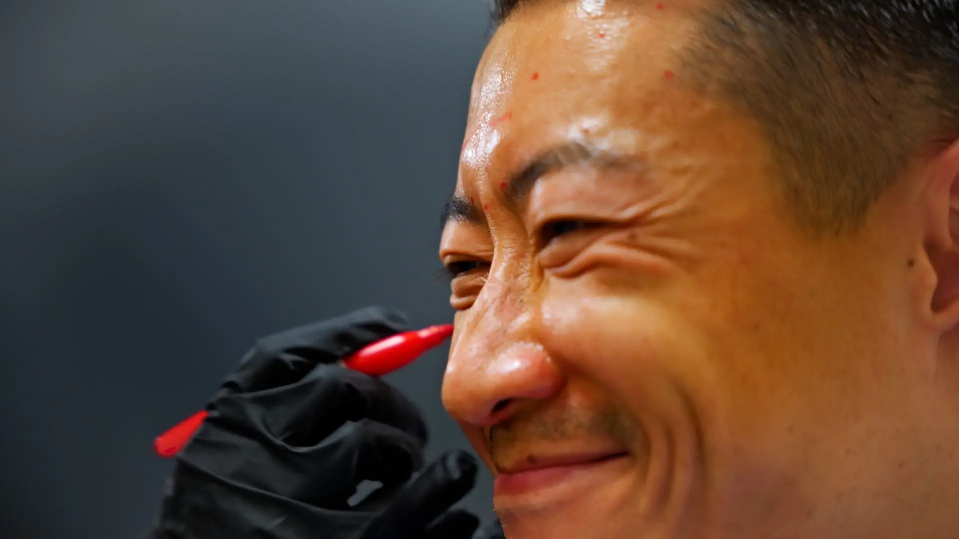 Botox Calgary specialist at New Skin YYC injecting Botox near a client’s eyebrow