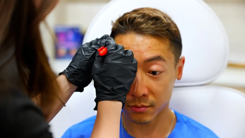 Botox Specialist Administering Forehead Injection at Aesthetic Clinic Aesthetician injecting Botox into a woman's forehead in a clinical skincare setting